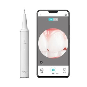 product_奇妙_素诺智能可视超声波洁牙仪T11Pro