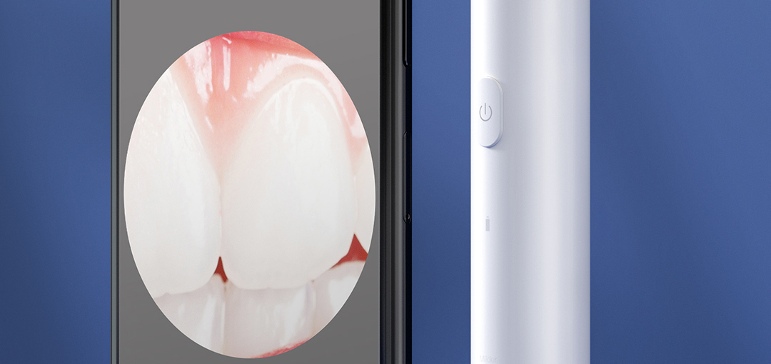 product_奇妙_素诺智能可视超声波洁牙仪T11Pro