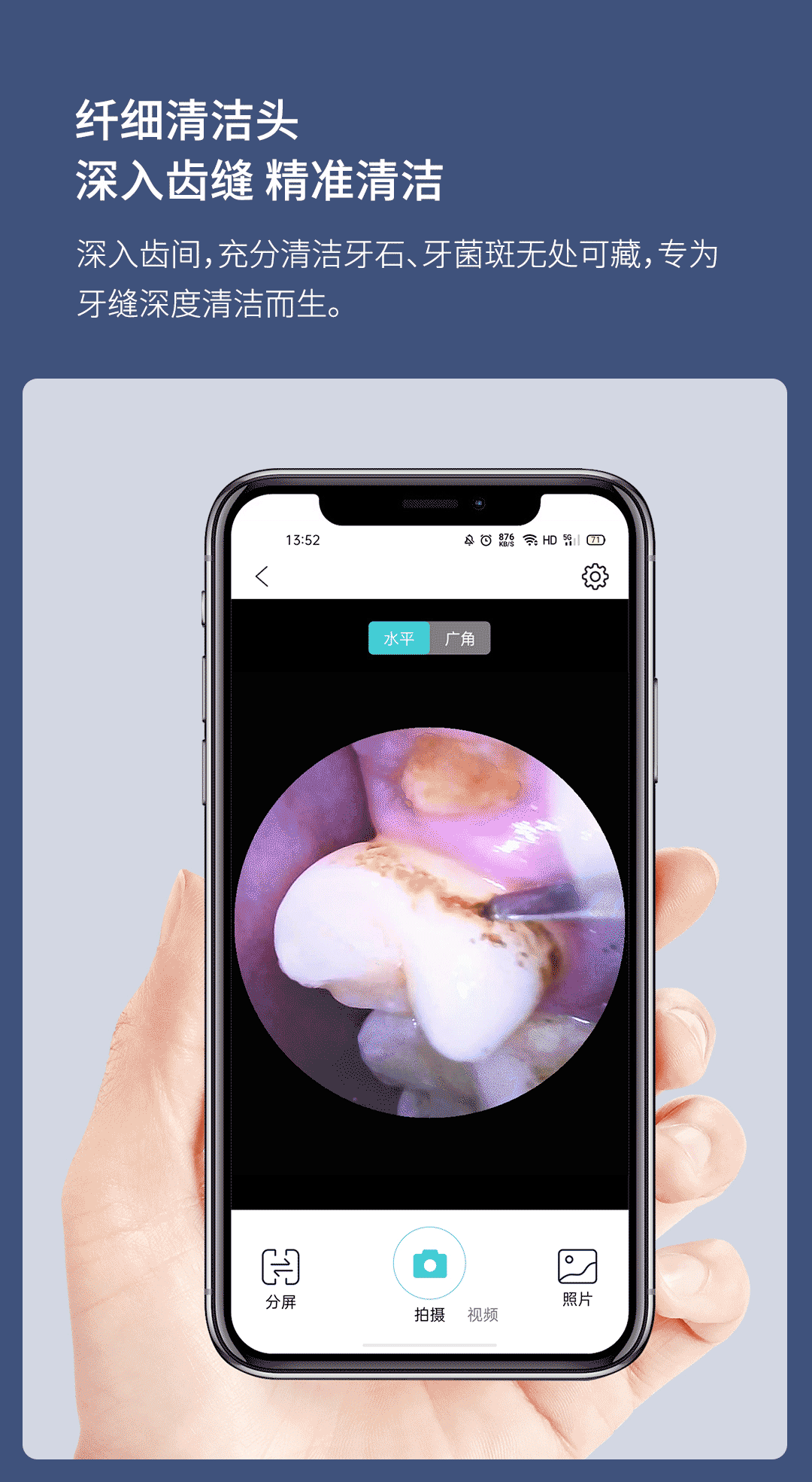 product_奇妙_素诺智能可视超声波洁牙仪T11Pro