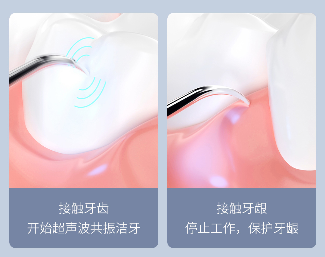 product_奇妙_素诺智能可视超声波洁牙仪T11Pro