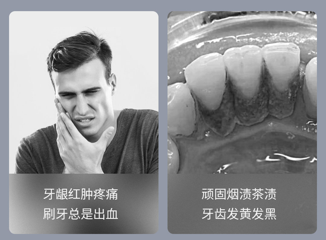 product_奇妙_素诺智能可视超声波洁牙仪T11Pro